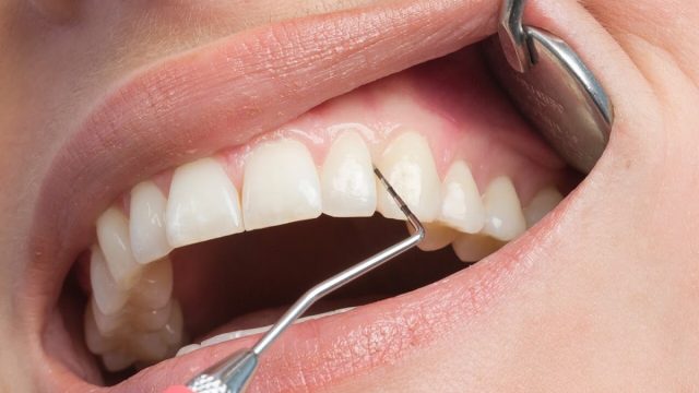 Ukiah Dental | Dr. Richard S. Phillips DDS